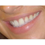 Терапевтическое лечение твёрдых тканей зуба и пародонта