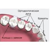 Лечение аномалий зубо-челюстной системы.Киев фото