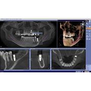 рентгенология в стоматологии фото