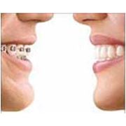 Ортодонтия цифровая OrthoCAD фото