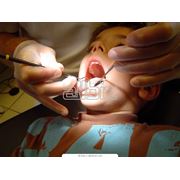 Ортодонтия для подростков и взрослых в клинике Біленька усмішка цена в Житомире фото