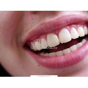 Профессиональная гигиена полости рта Киев Важнейшим и неотъемлемым этапом стоматологических лечебных мероприятий является профессиональная гигиена полости рта. фото