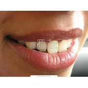 Лечение и профилактика зубов фото