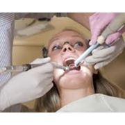 Широкий спектр стоматологических услуг фото
