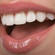 Художественная реставрация зубов