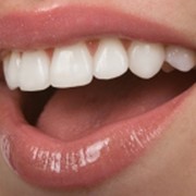 Имплантация зубов, Стоматологические услуги