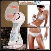 Устройство от целлюлита Целлюлес МД (Celluless MD) НОВИНКА!!! фото