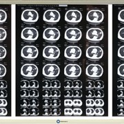 Светодиодный негатоскоп для трех рентгеновских снимков фото