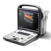 Портативный ультразвуковой сканер Черно-белый A6 sonoscape + датчик в комплекте фото