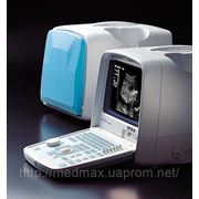 Ультразвуковой сканер HS-2000 фото