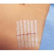 Пластырные полоски для бесшовного сведения краев раны Steri-Strip, размеры 6мм x 38мм. (R1542) фото