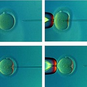 Инъекция сперматозоида в яйцеклетку (ИКСИ) в клинике репродуктивной медицины имени академика В.И. Грищенко фотография