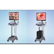 Видео-кольпоскоп MEDISCOPE цифровая медицинская видеокамера видеокольпоскоп гинекологический