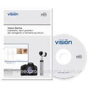 Vision Derma ПО для практической работы, подготовки отчетов и ведения дерматоскопических случаев фотография