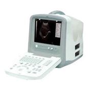 УЗИ аппарат прибор для ультразвукового исследования диагностики CHISON 8300