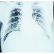 Пленка рентгеновская Кровлекс фото