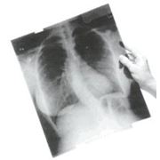 Пленка рентгеновская фотография