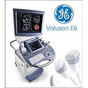 УЗИ GE Voluson E6 soft BT-09 2009г. ультразвуковая система Voluson® E6 фото