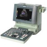 Ультразвуковой сканер Mini Focus 1402