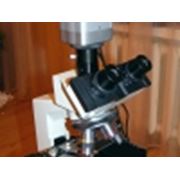 Темнопольный микроскоп для гемосканирования (микроскопия нативной крови гемоскопия скрининг). фото