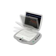 Портативный ультразвуковой аппарат Orcheo Lite CV для кардиологии фото