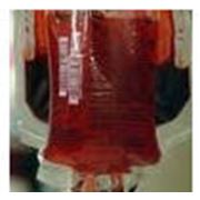 Система для переливания крови устройства для переливания крови фото