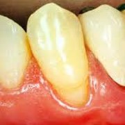 Консультации челюстно-лицевого хирурга фото