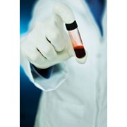 Анализ крови в лаборатории МЦ «Эскулап» фотография