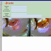 Обеспечение программное `LEDA` рабочего места врача-гинеколога фото