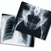 Отходы рентген кабинетов фото