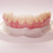 Имплантация зубов Протезирование зубов фото