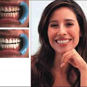 Эстетическая стоматология: виниры. фотография