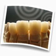 Услуги зуботехнической лаборатории фото