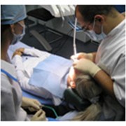 Удаление зуба фото