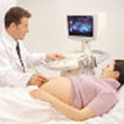 Ультразвуковое исследование для беременных фото
