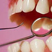 Лечение зубов и каналов