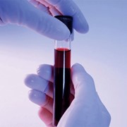 Исследование крови в клинике BioTexCom фото