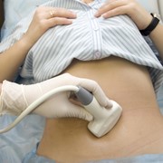 Ультразвуковое исследование вагинальное в клинике BioTexCom Ukraine