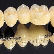 Металлокерамические коронки фото