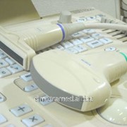 Ультразвуковые исследования лимфатических узлов, Ирпень фото