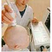 Нейросонография (НСГ) - ультразвуковое сканирование мозга младенцев. фотография