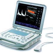 Портативная диагностическая цифровая система с цветным доплером M-5 фото