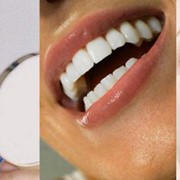 Косметическая стоматология