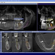 3D-рентгеновская съемка. Аппараты рентгеновские для стоматологических кабинетов
