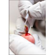Клинический анализ крови с лейкоцитарной формулой (ОАК) фото