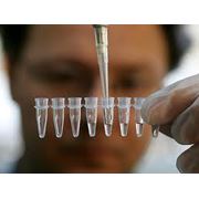 Дородовой тест на отцовство фото