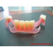 Протезирование зубов съемное Валпласт Стоматологические услуги Ортопедическая стоматология фото