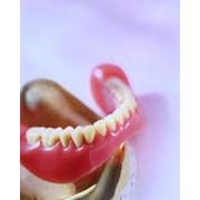 Съёмное протезирование зубов фотография