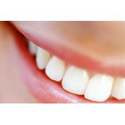 Косметическое восстановление зубов