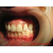 Отбеливание зубов Стоматологические услуги Стоматология фотография